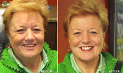 Before & After